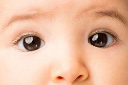 Lác mắt ở trẻ sơ sinh có đáng lo ngại?