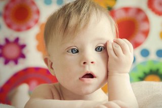Bệnh Down ở trẻ sơ sinh: Nguyên nhân và cách điều hỗ trợ điều