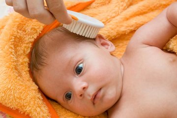 Trẻ sơ sinh bị rụng tóc - dấu hiệu trẻ đang gặp vấn đề về sức khỏe?