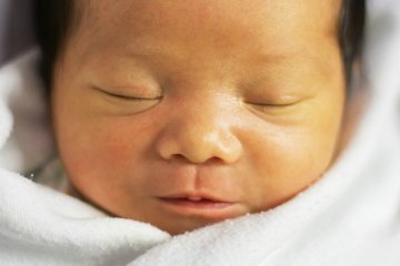 Hiện tượng vàng da ở trẻ sơ sinh và những điều bố mẹ nên biết