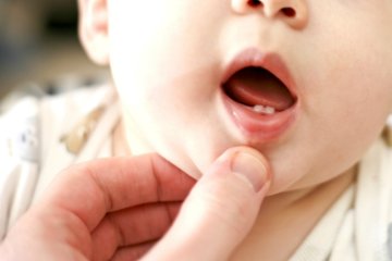 Trẻ chậm mọc răng, bố mẹ phải làm sao?