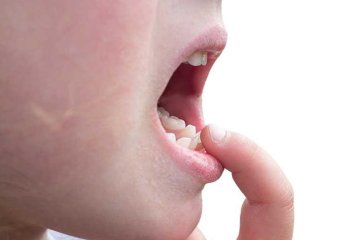 Trẻ bị hô xương hàm: Nguyên nhân và cách điều trị