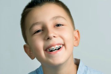 Khi nào nên niềng răng cho trẻ?