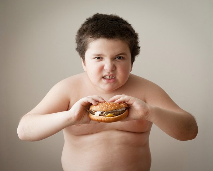 trẻ béo phì có nguy cơ gì