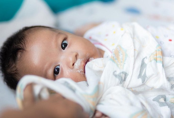 Em bé bị trào ngược dạ dày thực quản ở trẻ sơ sinh 
