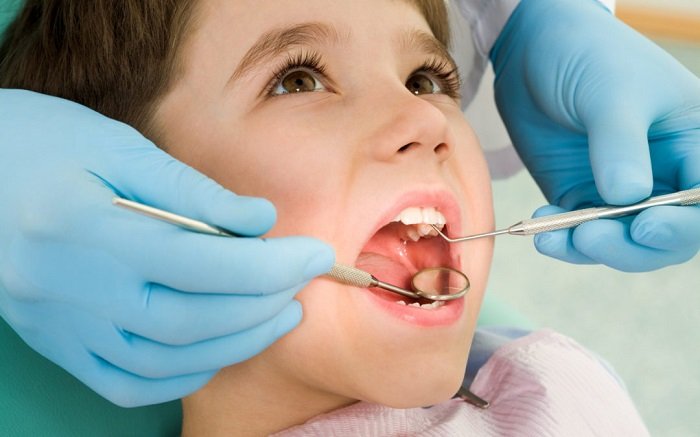 cách ngừa sâu răng cho bé