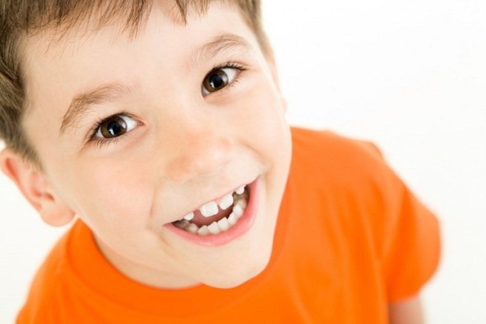 Di truyền là một trong những nguyên nhân khiến trẻ bị hô xương hàm.